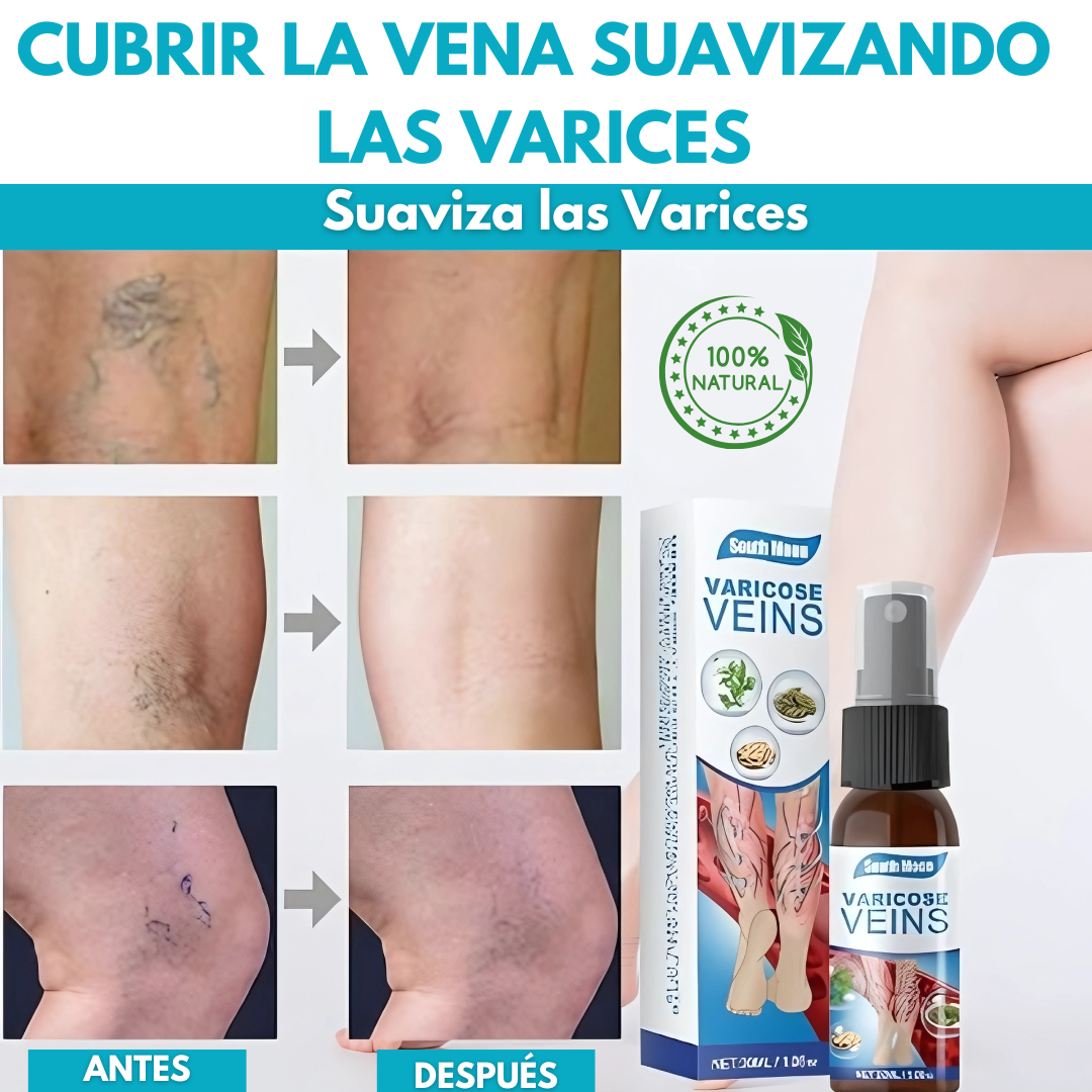 Spray Anti Varices Vitalia®