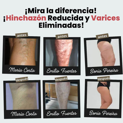 Calcetines de acupresión VITALIA® Incluye spray GRATIS