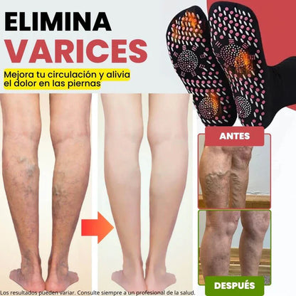 Calcetines de acupresión VITALIA® Incluye spray GRATIS